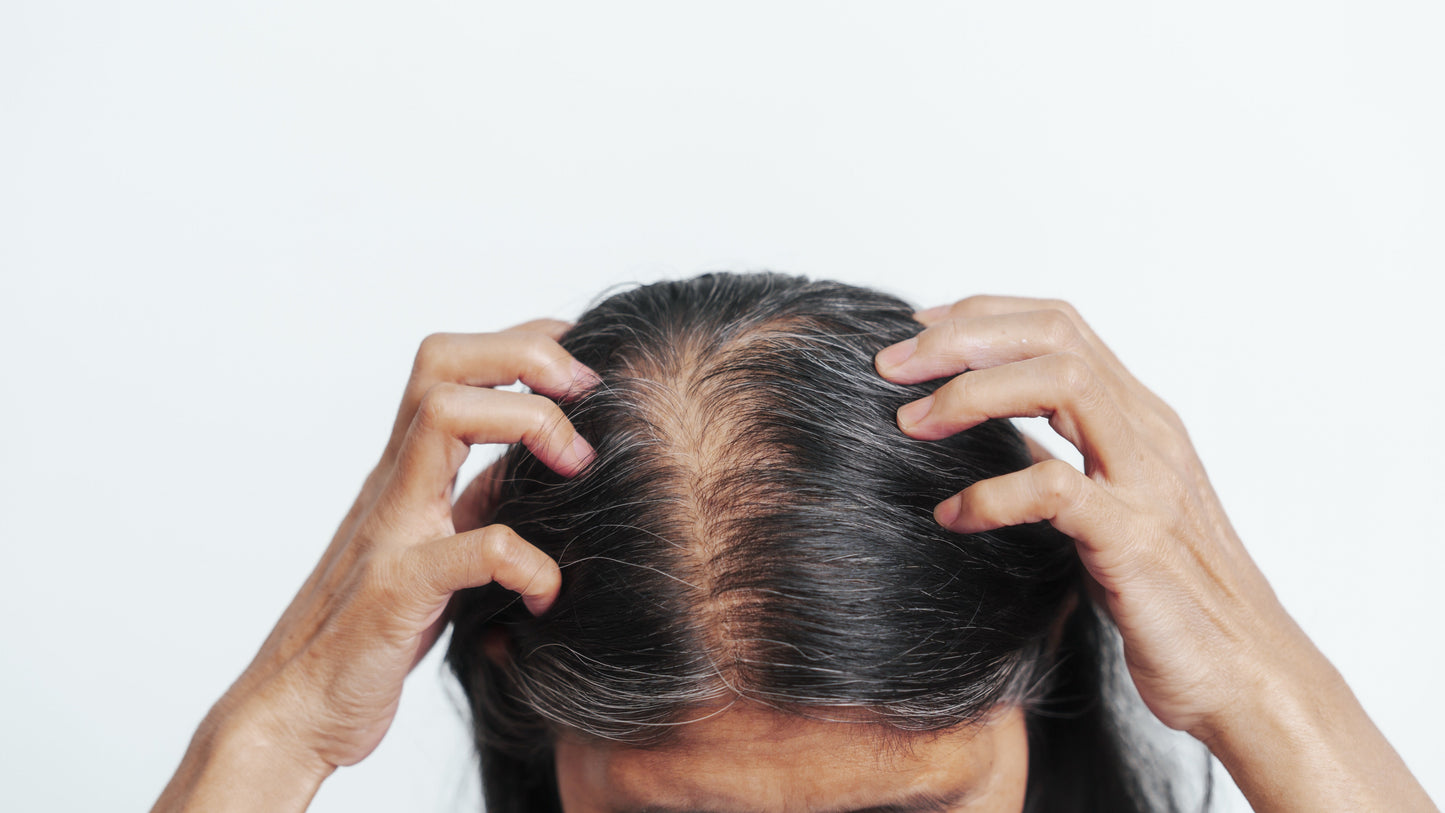 NMN and Hair Quality in Middle-Aged Women: Findings From an Exploratory Clinical Study